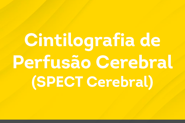 Cintilografia de Perfusão Cerebral (SPECT Cerebral)